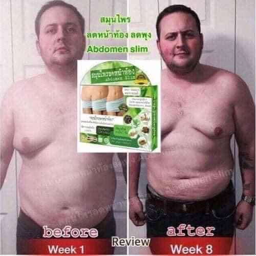 Viên uống thảo mộc giảm mỡ bụng Abdomen Slim